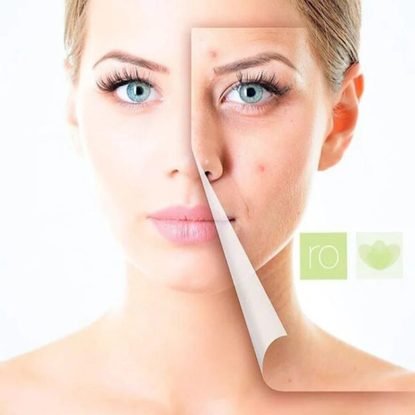 تونر پوست چرب آنوبیس