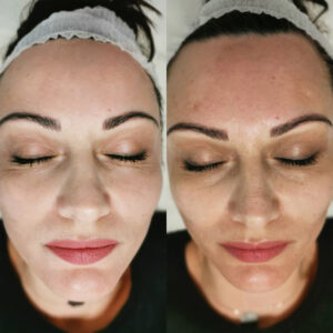 ماسک خاویار آنوبیس