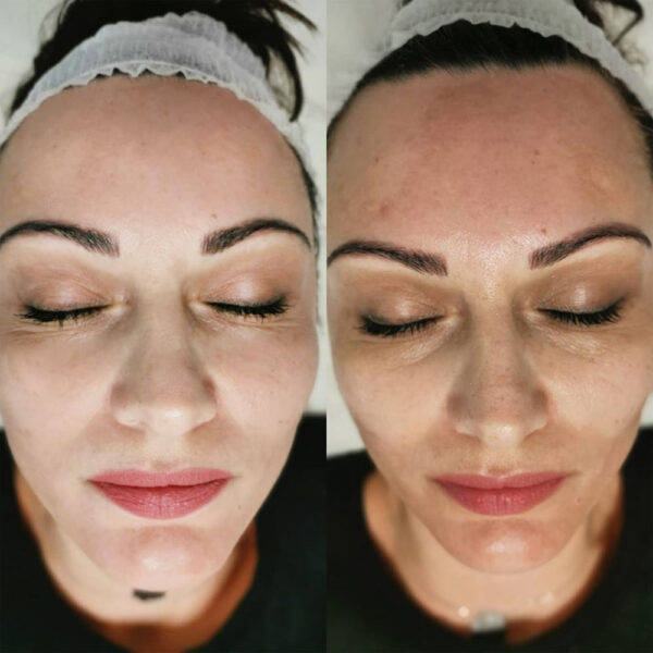 ماسک خاویار آنوبیس