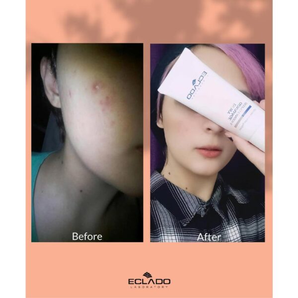 ژل لایه بردار گماژ اکلادو