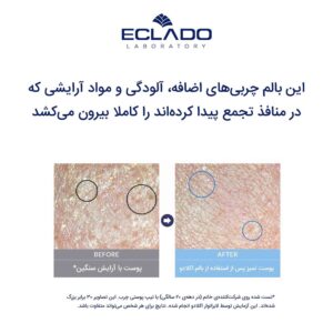 بالم پاک کننده پرفکت اسموتی اکلادو