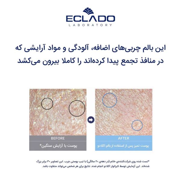 بالم پاک کننده پرفکت اسموتی اکلادو