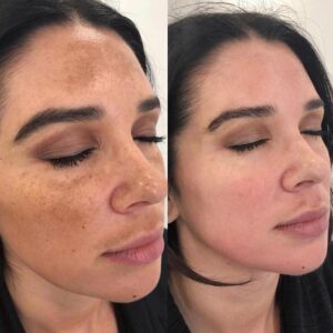 ماسک ضد لک و روشن کننده آنوبیس