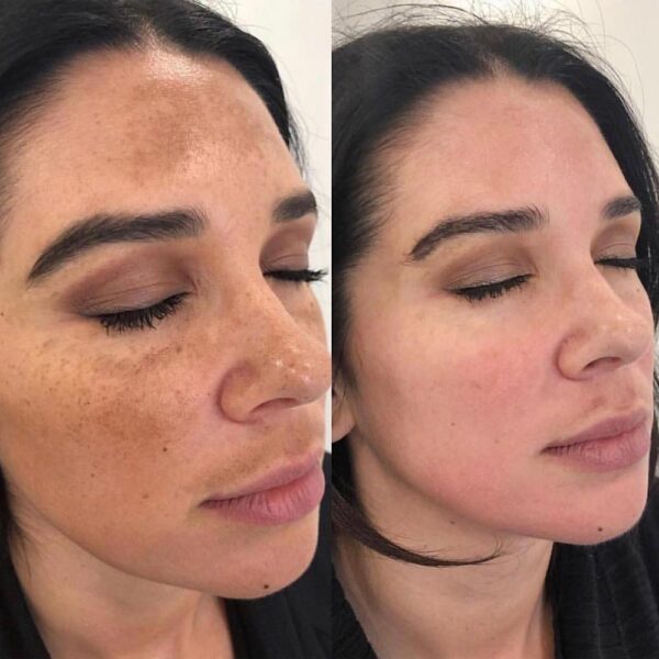 ماسک ضد لک و روشن کننده آنوبیس