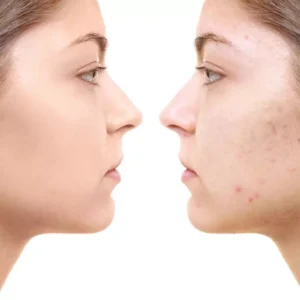 شوینده سالیسیلیک ام ای دی M.A.D