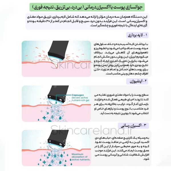 دستگاه پلاژن پرتابل