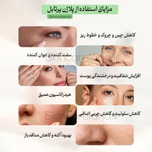 دستگاه پلاژن پرتابل