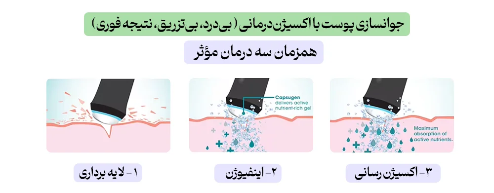 عملکرد پلاژن تراپی